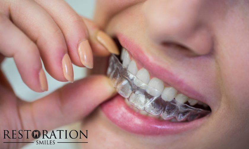 Aligning Brilliance: The Aesthetic Touch Of An Invisalign Dentist