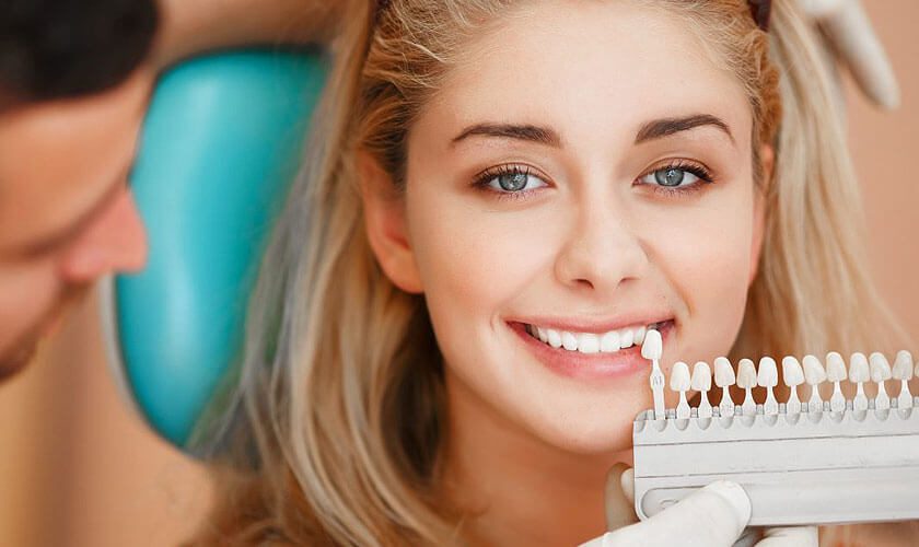 Top 3 Things About Porcelain Veneers