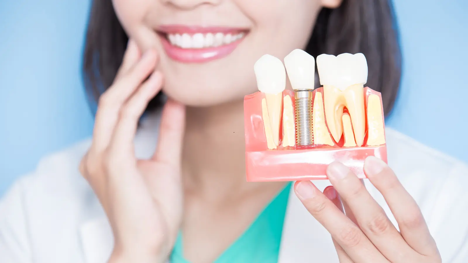 Are You An Ideal Implant Candidate