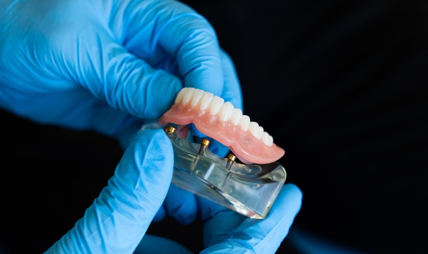 valuable tips to keep your dentures stain free