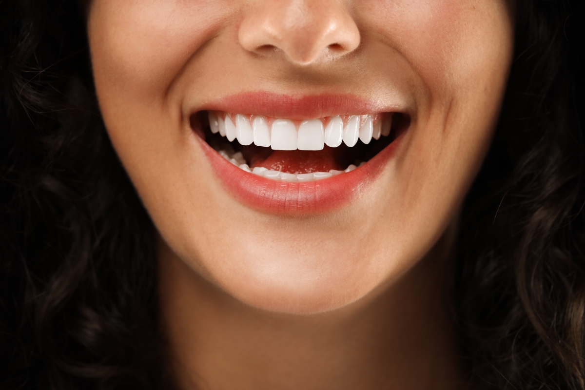 porcelain-veneers-in-Tomball-TX